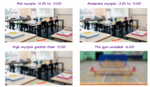 What children with myopia see